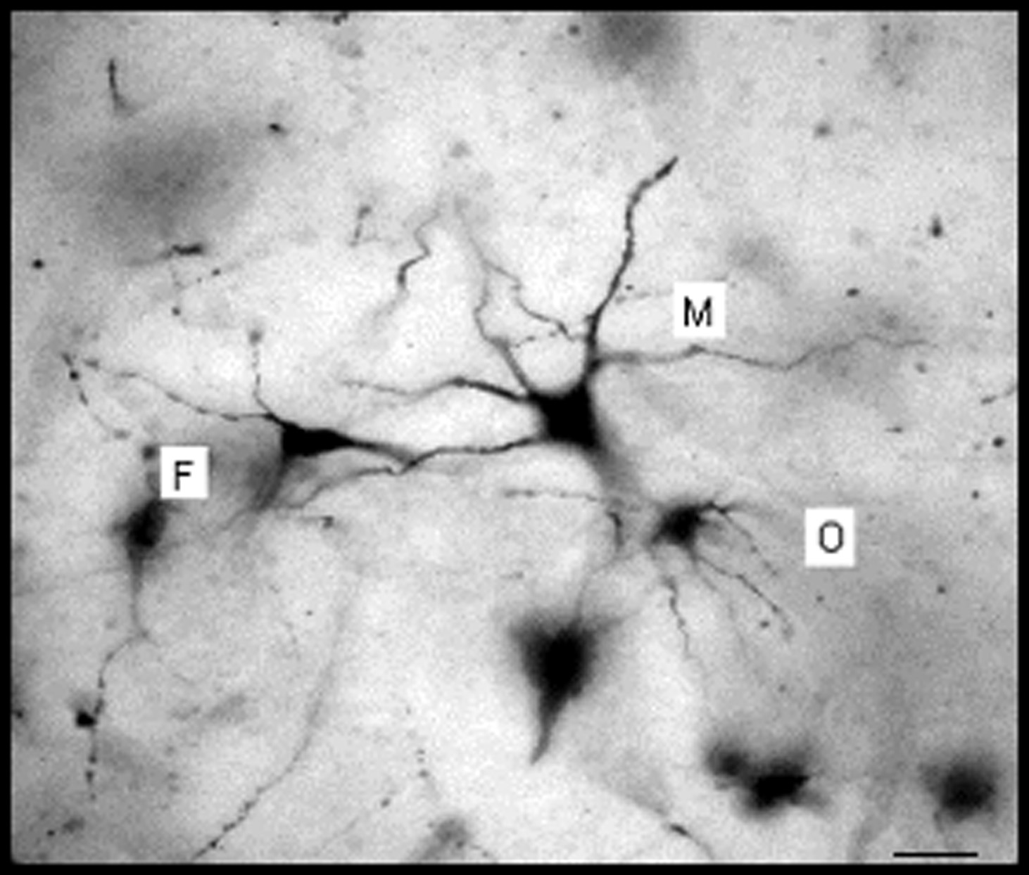 multipolar (M); ovoid (O) and, fusiform (F) neurons of the STNr